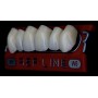 Denti Ref-Line anteriori Superiori